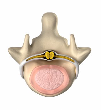 normal intervertebral disk, omurilik ve çekirdeği pulposus - Üstten Görünüm