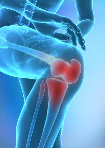 Zranění lidského kolene — Stock fotografie