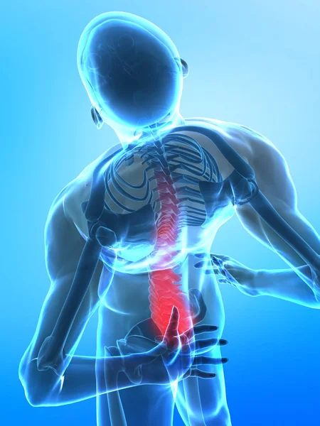 Pain in spine concept — Stock Photo, Image