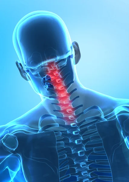 Dolor en el concepto de columna cervical — Foto de Stock