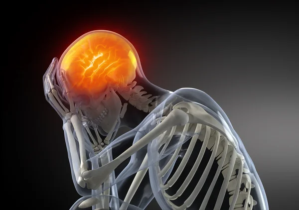 Head Pain concept — Stock Photo, Image