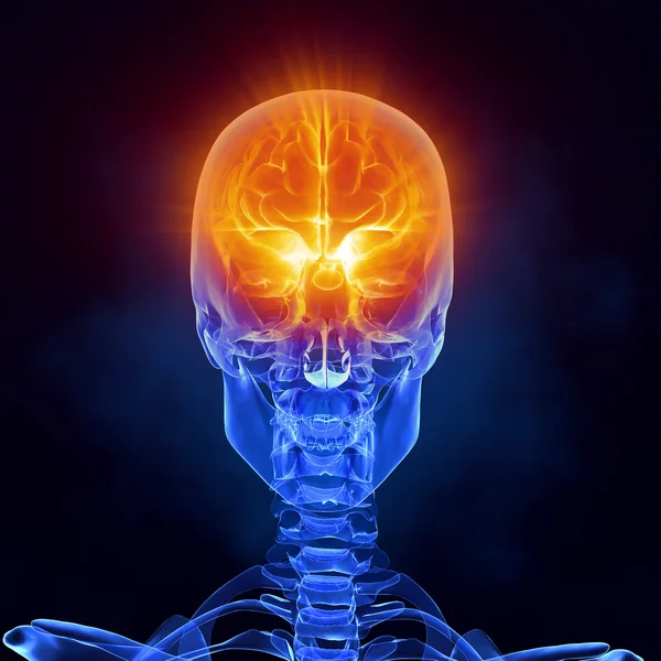 X-ray brain medical scan front view — Stock Photo, Image