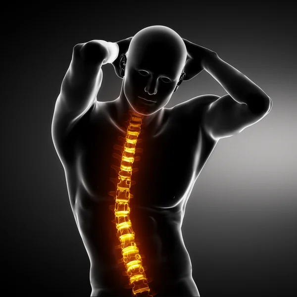 Escaneamento de espinha dorsal do corpo masculino — Fotografia de Stock