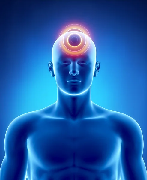 Migraine and headache concept — Stock Photo, Image