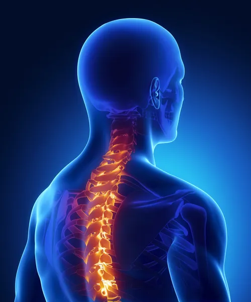 Lesión de columna vertebral en rayos X — Foto de Stock