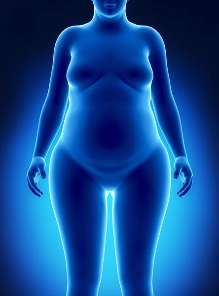 Fat woman anterior view — Stock Photo, Image