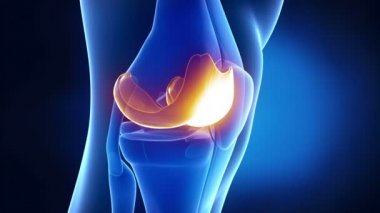 x-ışını diz Menisküs tıbbi anatomisi