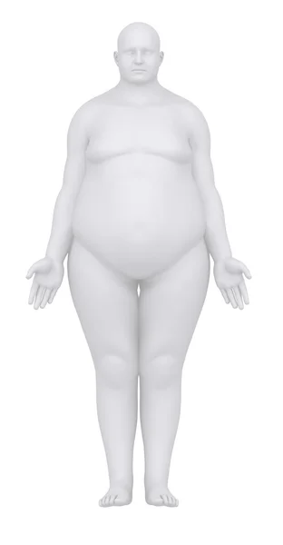 Uomo obeso in posizione anatomica vista anteriore — Foto Stock
