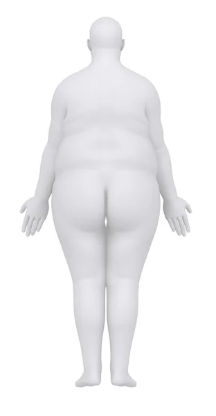 Uomo obeso in posizione anatomica vista posteriore — Foto Stock