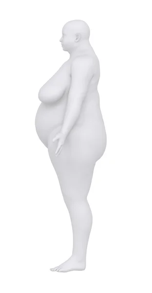 Obese woman in anatomical position lateral view — Stock Photo, Image