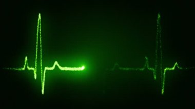 EKG animasyon