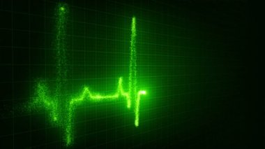 EKG animasyon