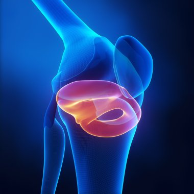 Menisküs yaralanmaları