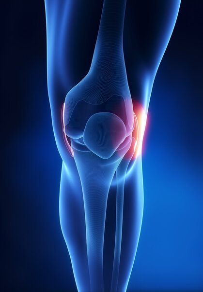 Lateral Collateral Ligament knee injury