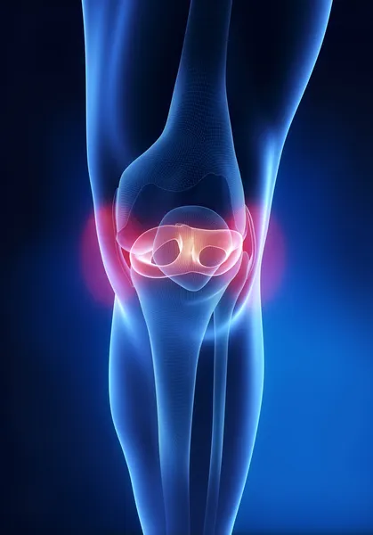 Meniscal Injuries — Stock Photo, Image