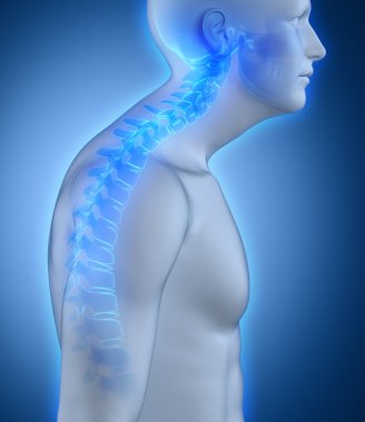 Kyphotic spine lateral view clipart