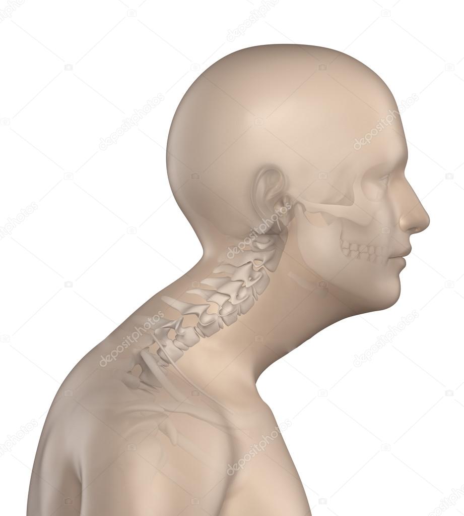 Kyphotic spine in cervical region phase 3