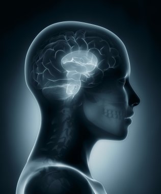 Beyin sapı tıbbi x-ray tarama