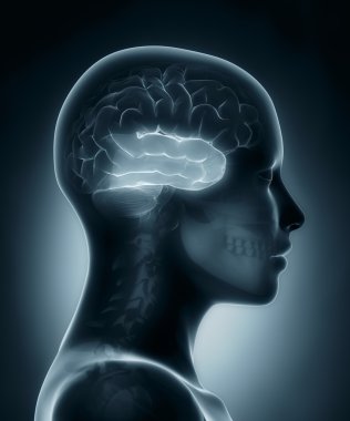 temporal lob tıbbi x-ray tarama