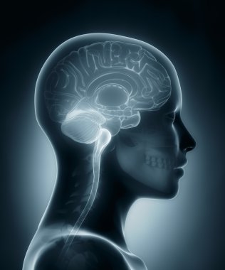 Female brain medical x-ray scan clipart