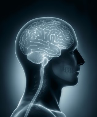 insan beyni tıbbi x-ray tarama