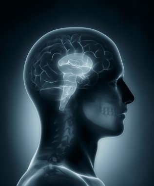 Beyin sapı tıbbi x-ray tarama
