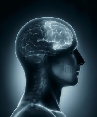 frontal lob tıbbi x-ray tarama