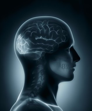 oksipital lob tıbbi x-ray tarama