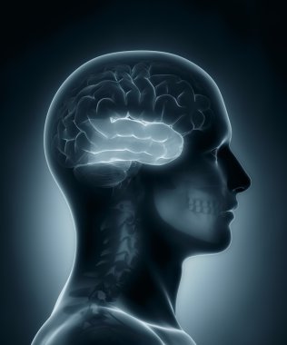 temporal lob tıbbi x-ray tarama