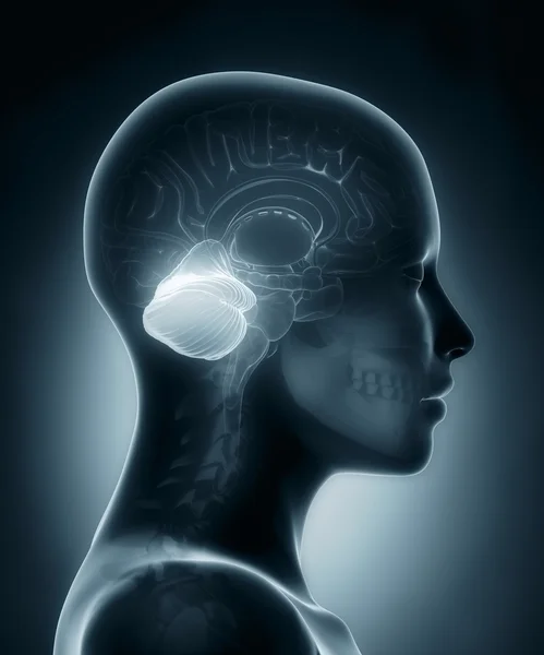 Raio-X médico do cerebelo — Fotografia de Stock