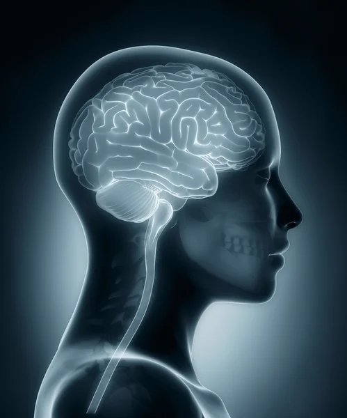 Exploración de rayos X médicos del cerebro femenino — Foto de Stock