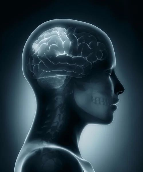Mozkovém laloku lékařské x-ray skenování — Stock fotografie