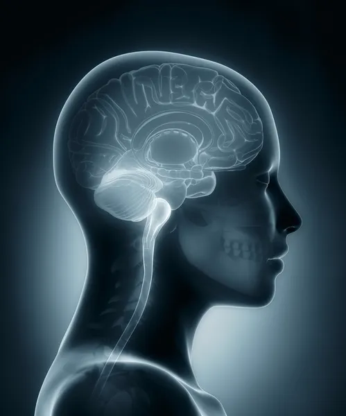 Female brain medical x-ray scan — Stock Photo, Image