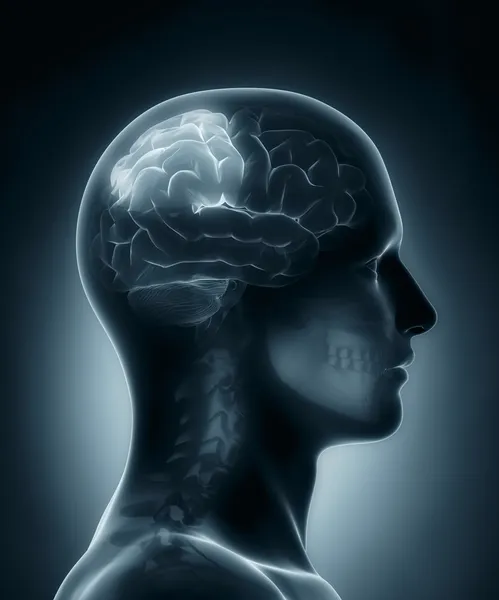 Parietal lobe medical x-ray scan — Stock Photo, Image