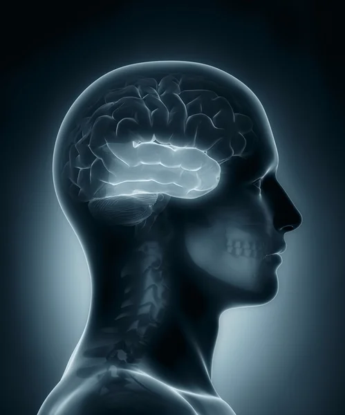 Temporal lobe medical x-ray scan — Stock Photo, Image