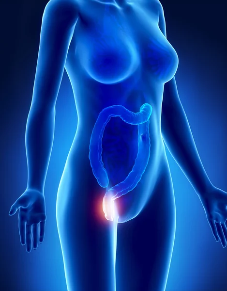 Female HEMORRHOIDS concept x-ray lateral view — Stock Photo, Image