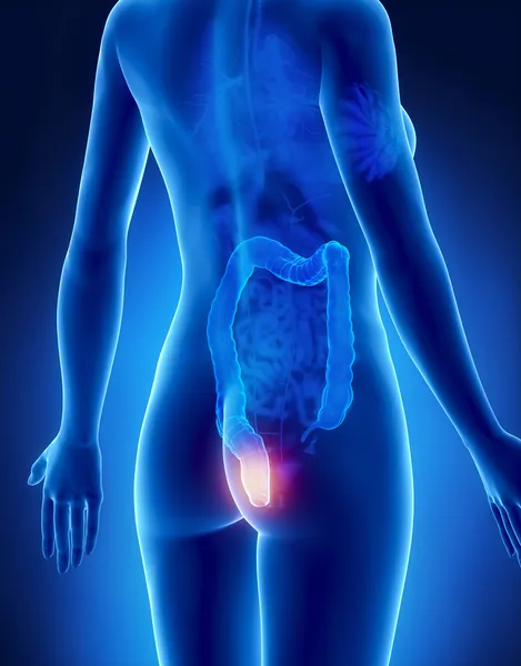 dişi hemoroid kavramı x-ray yan görünüm