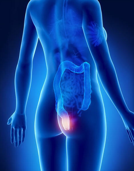 Female HEMORRHOIDS concept x-ray lateral view