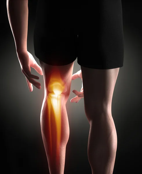 Man knie pijn concept — Stockfoto