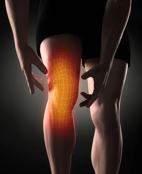 Concepto de dolor de rodilla hombre — Foto de Stock