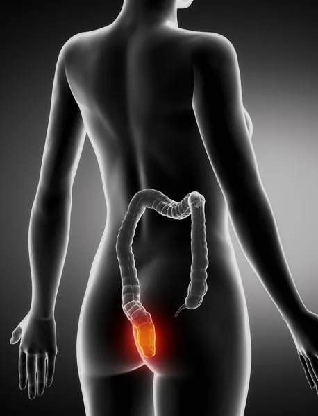 Female HEMORRHOIDS concept anatomy x-ray posterior view — Stock Photo, Image