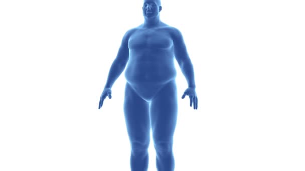 El hombre - de la obesidad al adelgazamiento en el lapso de tiempo — Vídeo de stock