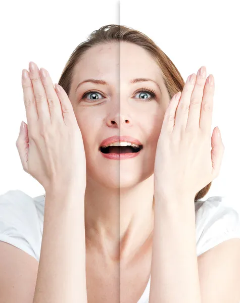 Retrato da mulher antes e depois de cuidados com a pele isolado em branco — Fotografia de Stock