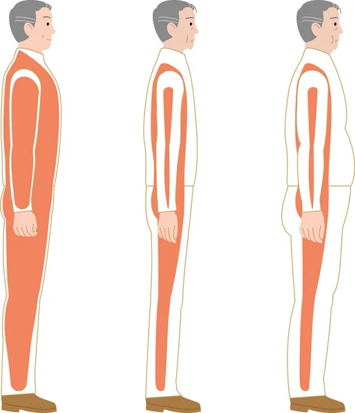 Perte Masse Musculaire Sarcopénie Obésité Homme Âgé — Image vectorielle