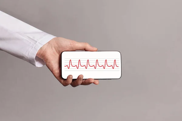 Doctor hand holding smartphone screen display with heartbeat cardiogram on gray