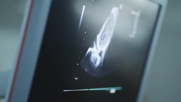 Ecocardiografia Moderna Máquina Tela Mostrando Ultra Som Coração Dos Meninos — Vídeo de Stock