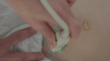Hastanede Ultrason Muayenesi yaptıran bir çocuğun yakın çekimi. Doktor ultrason taraması yapıyor. Yavaş Hareket Üst Görünüm Görüntüsü