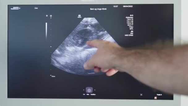 Screen Modern Ultrasound Machine Hospital While Young Boys Healthcheck Доктор — стоковое видео