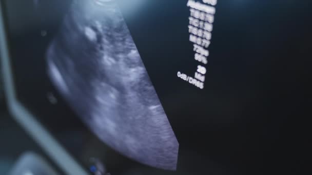 病院で現代の超音波マシンの画面ながら 若い男の子の健康チェック 医者が画面を指差す スローモーションサイドビュー パン撮影 — ストック動画