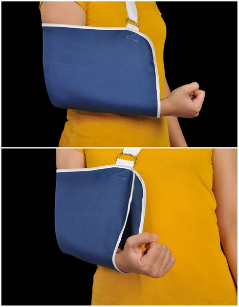 Medicinskt stöd hand sling — Stockfoto